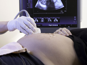 Zajść w ciążę po pierwszym in vitro